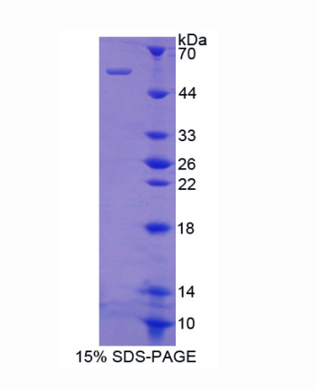 微管蛋白ε(TUBe)重组蛋白,Recombinant Tubulin Epsilon (TUBe)