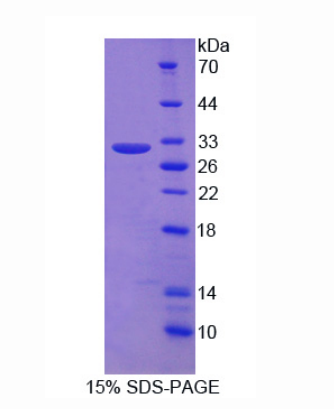 肌球蛋白轻链6B(MYL6B)重组蛋白,Recombinant Myosin Light Chain 6B, Alkali, Smooth Muscle And Non Muscle (MYL6B)