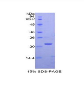 T-细胞表面糖蛋白CD3ε(CD3e)重组蛋白,Recombinant T-Cell Surface Glycoprotein CD3 Epsilon (CD3e)