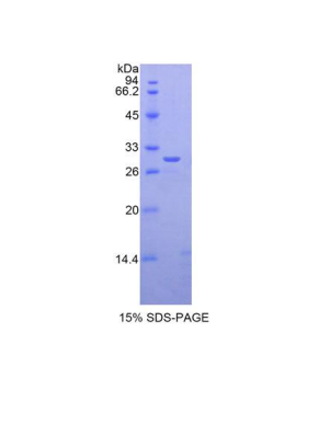 GLI家族锌指蛋白3(GLI3)重组蛋白,Recombinant GLI Family Zinc Finger Protein 3 (GLI3)