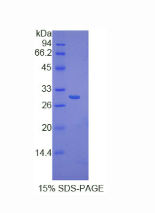 核因子κB抑制因子δ(IkBd)重组蛋白,Recombinant Inhibitory Subunit Of NF Kappa B Delta (IkBd)