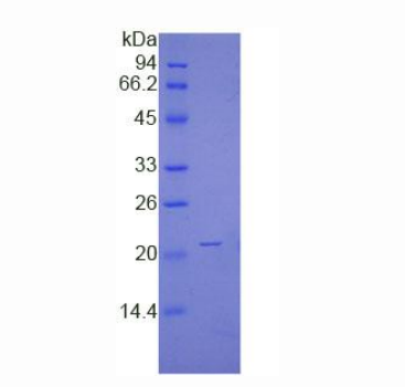 非转移细胞1表达NM23A蛋白(NME1)重组蛋白,Recombinant Non Metastatic Cells 1, Protein NM23A Expressed In (NME1)