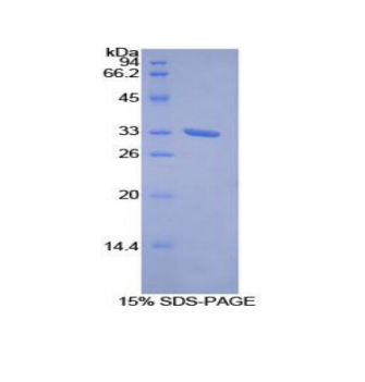 受体酪氨酸激酶样孤儿素受体1(ROR1)重组蛋白,Recombinant Receptor Tyrosine Kinase Like Orphan Receptor 1 (ROR1)