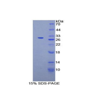 Axis抑制蛋白(AXIN)重組蛋白,Recombinant Axis Inhibition Protein (AXIN)