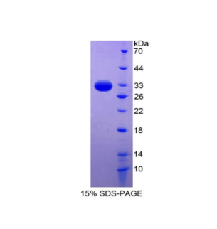 核因子κB抑制因子β(IkBb)重组蛋白,Recombinant Inhibitory Subunit Of NF Kappa B Beta (IkBb)