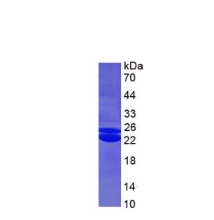 非转移细胞2表达NM23A蛋白(NME2)重组蛋白,Recombinant Non Metastatic Cells 2, Protein NM23B Expressed In (NME2)