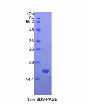 非转移细胞4表达NM23A蛋白(NME4)重组蛋白,Recombinant Non Metastatic Cells 4, Protein NM23A Expressed In (NME4)