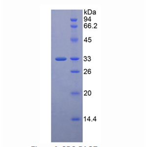 低密度脂蛋白受体相关蛋白5(LRP5)重组蛋白