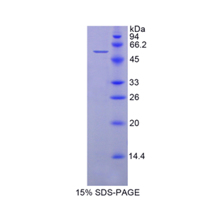 70kDa热休克蛋白14(HSPA14)重组蛋白
