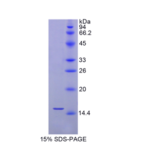 硒蛋白X1(SEPX1)重组蛋白