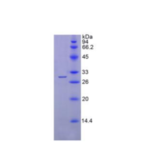 鞘氨醇1磷酸酯裂解酶1(SGPL1)重组蛋白