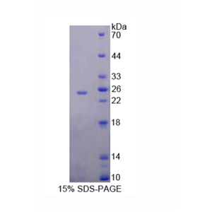 泛连接蛋白1(PANX1)重组蛋白,Recombinant Pannexin 1 (PANX1)