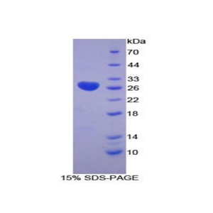 赖氨酰氧化酶样蛋白3(LOXL3)重组蛋白,Recombinant Lysyl Oxidase Like Protein 3 (LOXL3)