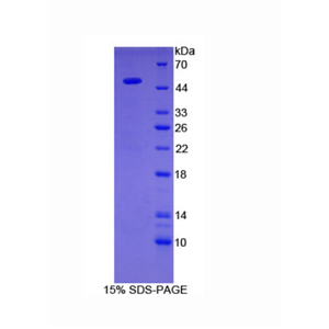 半乳糖-3-O-磺基轉(zhuǎn)移酶1(GAL3ST1)重組蛋白,Recombinant Galactose-3-O-Sulfotransferase 1 (GAL3ST1)