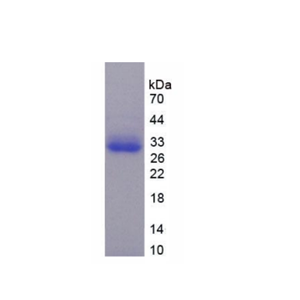 TNFRSF1A关联Via死亡域蛋白(TRADD)重组蛋白,Recombinant TNFRSF1A Associated Via Death Domain Protein (TRADD)