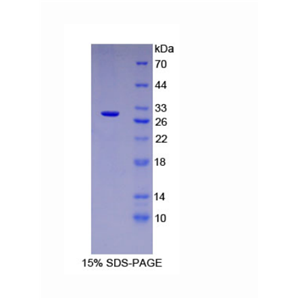 微管蛋白β6(TUBb6)重组蛋白