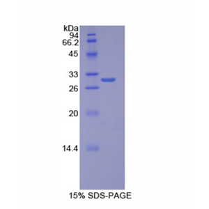 耐扭蛋白1B(TOR1B)重组蛋白