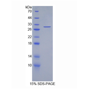 耐扭蛋白3A(TOR3A)重组蛋白,Recombinant Torsin 3A (TOR3A)