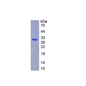亲核素α1(KPNa1)重组蛋白