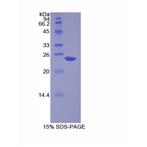 非转移细胞6表达蛋白(NME6)重组蛋白