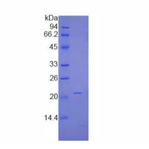 非转移细胞1表达NM23A蛋白(NME1)重组蛋白,Recombinant Non Metastatic Cells 1, Protein NM23A Expressed In (NME1)