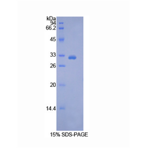 丙酮酸脱氢酶激酶4(PDK4)重组蛋白