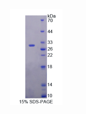 含DIX域蛋白1(DIXDC1)重組蛋白,Recombinant DIX Domain Containing Protein 1 (DIXDC1)