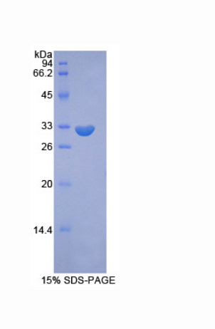 含FYVE指磷酸肌醇激酶(PIKFYVE)重组蛋白,Recombinant Phosphoinositide Kinase, FYVE Finger Containing (PIKFYVE)