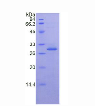 核因子κB抑制因子ε(IkBe)重组蛋白,Recombinant Inhibitory Subunit Of NF Kappa B Epsilon (IkBe)