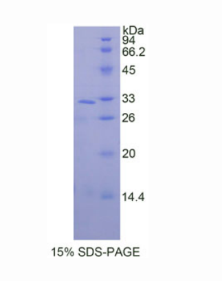 絲裂原激活蛋白激酶9(MAPK9)重組蛋白,Recombinant Mitogen Activated Protein Kinase 9 (MAPK9)