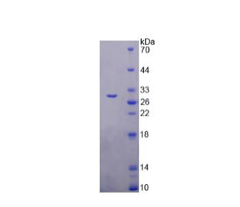 跨膜蛋白173(TMEM173)重组蛋白,Recombinant Transmembrane Protein 173 (TMEM173)