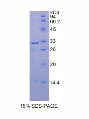 腫瘤調(diào)節(jié)蛋白1(TR1)重組蛋白,Recombinant Tomoregulin 1 (TR1)