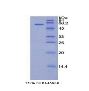 软骨中间层蛋白(CILP)重组蛋白,Recombinant Cartilage Intermediate Layer Protein (CILP)