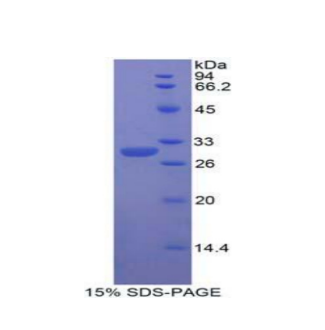 含δ/Notch样EGF重复蛋白(dNER)重组蛋白,Recombinant Delta/Notch Like EGF Repeat Containing Protein (dNER)