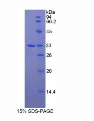 GRB2關(guān)聯(lián)結(jié)合蛋白3(GAB3)重組蛋白,Recombinant GRB2 Associated Binding Protein 3 (GAB3)