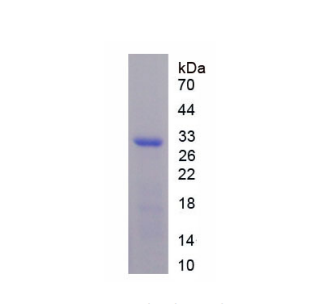 低密度脂蛋白受体相关蛋白3(LRP3)重组蛋白,Recombinant Low Density Lipoprotein Receptor Related Protein 3 (LRP3)