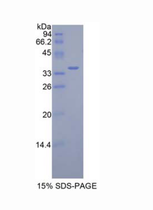 無(wú)補(bǔ)綴同源物1(DISP1)重組蛋白,Recombinant Dispatched Homolog 1 (DISP1)