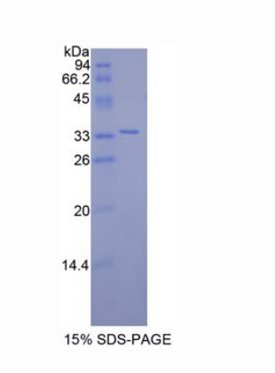 卷曲同源物10(FZD10)重組蛋白,Recombinant Frizzled Homolog 10 (FZD10)