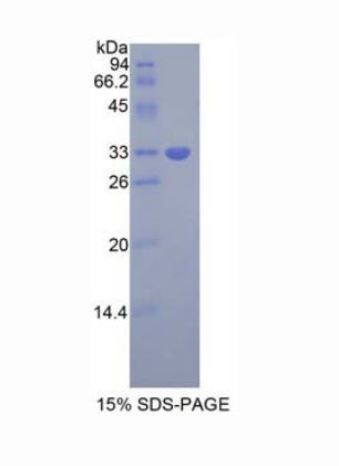 生长因子受体结合蛋白7(Grb7)重组蛋白,Recombinant Growth Factor Receptor Bound Protein 7 (Grb7)