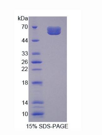 白介素20受体α(IL20Ra)重组蛋白,Recombinant Interleukin 20 Receptor Alpha (IL20Ra)