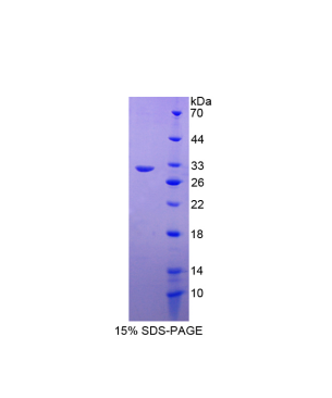 丝裂原激活蛋白激酶激酶2(MAP2K2)重组蛋白,Recombinant Mitogen Activated Protein Kinase Kinase 2 (MAP2K2)