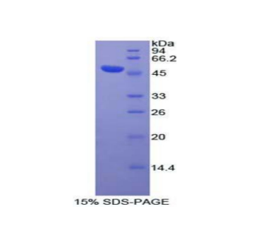 蓬乱蛋白Dsh同源物3(DVL3)重组蛋白,Recombinant Dishevelled, Dsh Homolog 3 (DVL3)