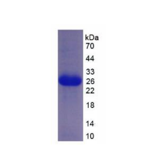 補綴同源物1(PTCH1)重組蛋白,Recombinant Patched Homolog 1 (PTCH1)