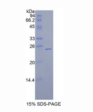 侧支发芽因子同源物1(SPRY1)重组蛋白,Recombinant Sprouty Homolog 1 (SPRY1)