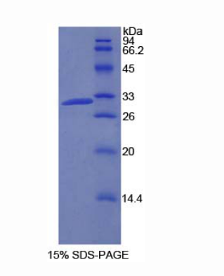 磷酸肌醇-3-激酶2β肽(PIK3C2b)重組蛋白,Recombinant Phosphoinositide-3-Kinase Class-2-Beta Polypeptide (PIK3C2b)