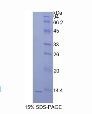 组蛋白1簇H4a(HIST1H4A)重组蛋白,Recombinant Histone Cluster 1, H4a (HIST1H4A)