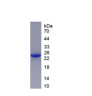 中间小电导钙激活钾离子通道亚家族N成员2(KCNN2)重组蛋白,Recombinant Potassium Intermediate Small Conductance Calcium Activated Channel Subfamily N, Member 2 (KCNN2)