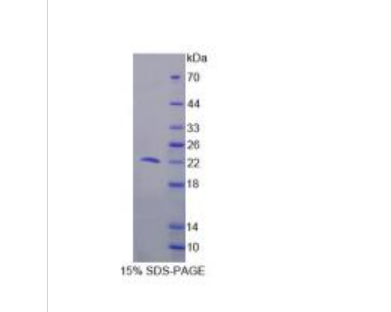 细胞程序性死亡蛋白6(PDCD6)重组蛋白,Recombinant Programmed Cell Death Protein 6 (PDCD6)