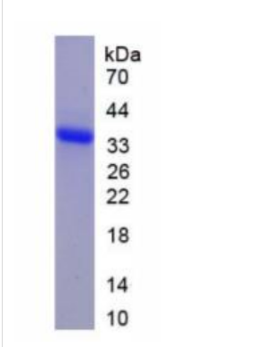 Wolfram综合征蛋白1(WFS1)重组蛋白,Recombinant Wolfram Syndrome Protein 1 (WFS1)