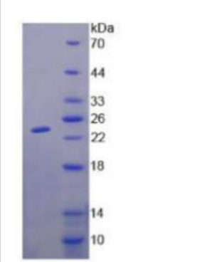 GM2神经节苷脂激活因子(GM2A)重组蛋白,Recombinant GM2 Ganglioside Activator (GM2A)